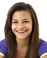 photo of girl with braces